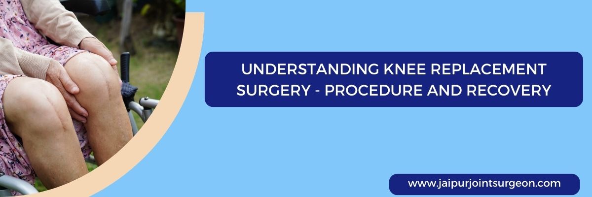 Understanding Knee Replacement Surgery: Procedure and Recovery